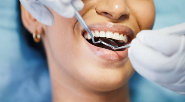 Best Emergency Dental Extractions in Riverview, MO