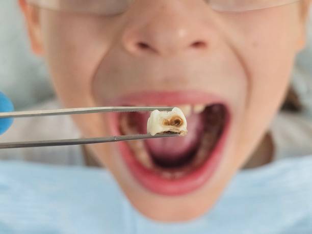 Best Emergency Dental Services for Seniors in Riverview, MO