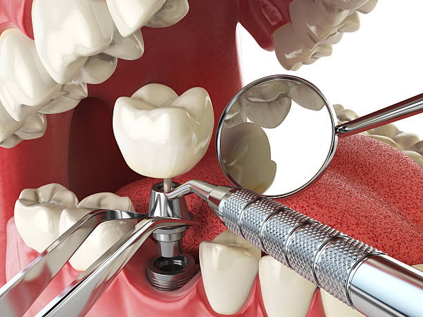 Best Orthodontic Emergency Dentist in Riverview, MO